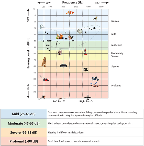 adult hearing test results